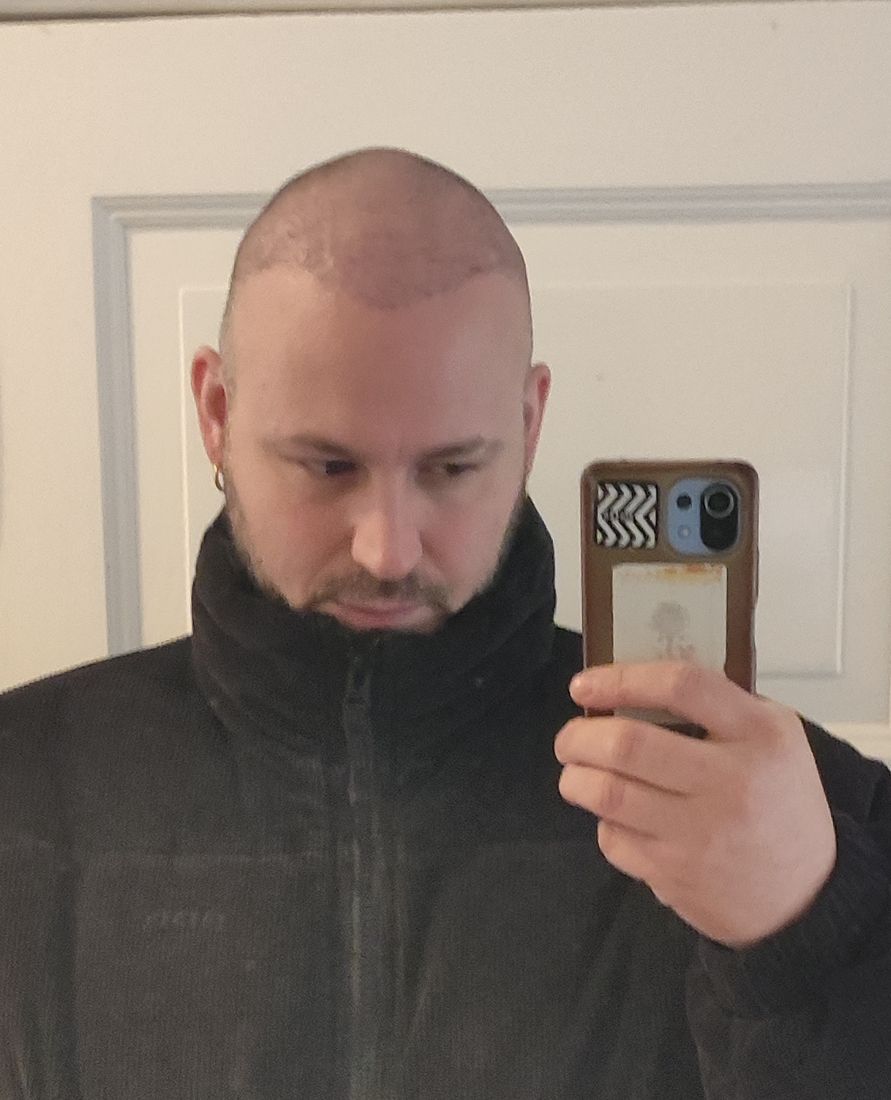 Man in a full length mirror about a month after a hair transplant with very short hair